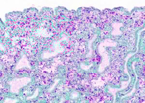 Make the invisible visible